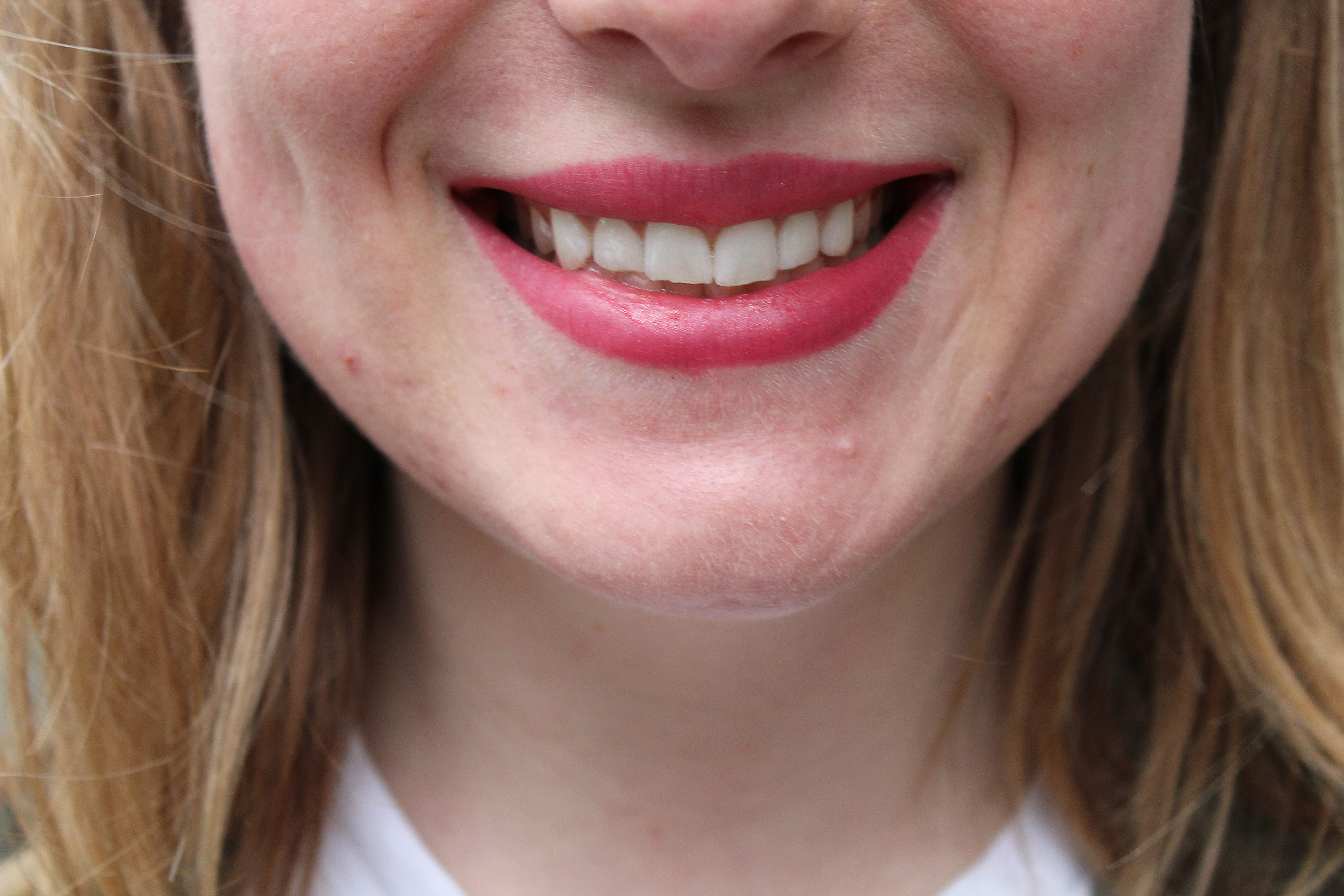 best teeth whitening smile brilliant